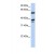 Western Blot: Hsp40 Antibody [NBP1-56645] - This Anti-DNAJB1 antibody was used in Western Blot of 721_B tissue lysate at a concentration of 1ug/ml.